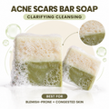 Acne & Scars Soap