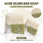 Acne & Scars Soap