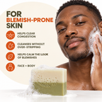 Acne & Scars Soap