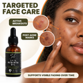 Acne Fading Oil