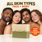 Acne & Scars Soap