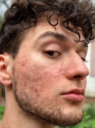 Made for Real Skin Concerns