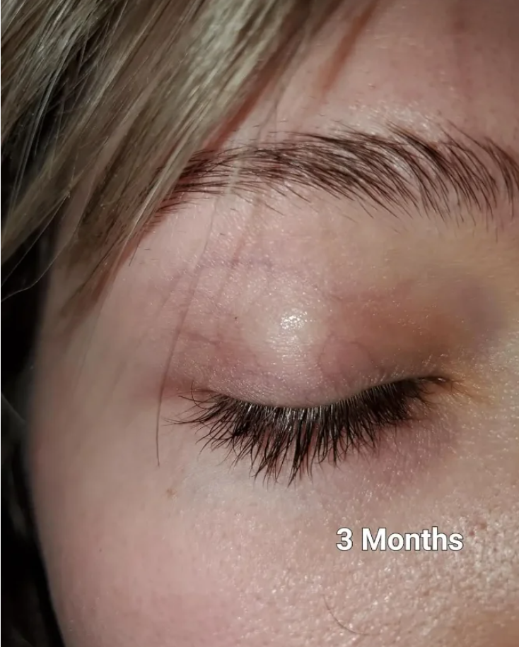 Eye Lash Growth