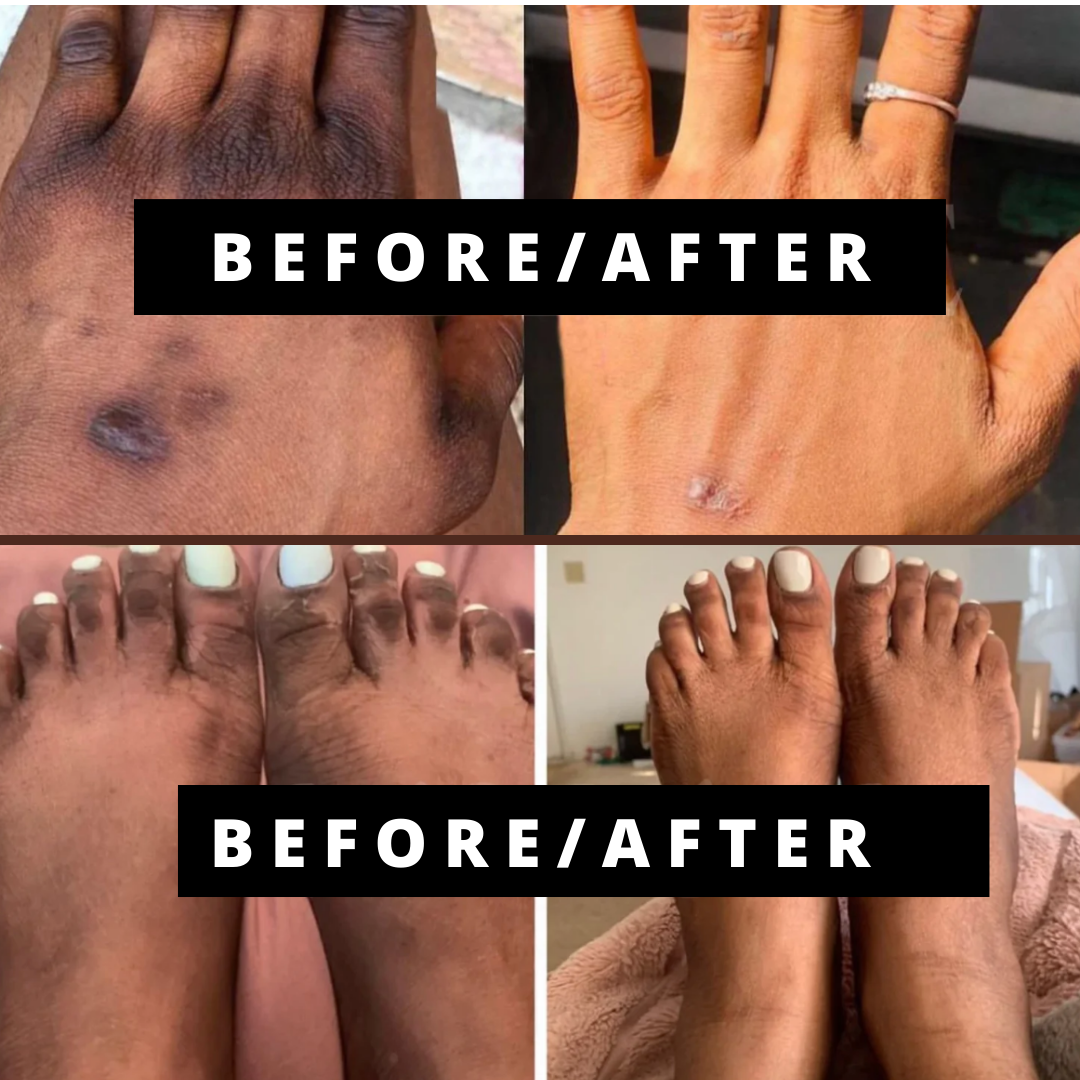 🌞AM Dark Knuckles Cream – SHOPSKINCLINIC