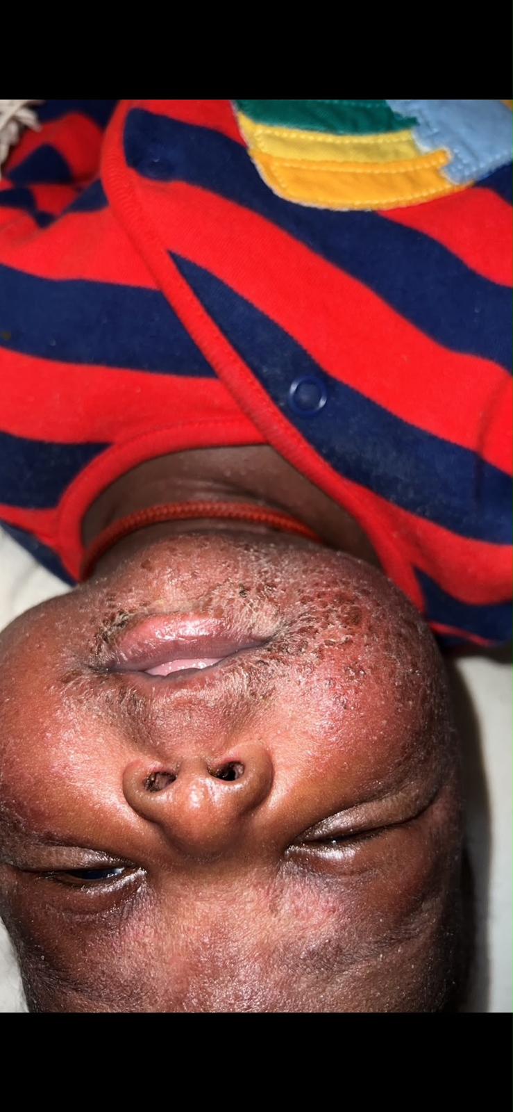Skin before using Little Skin